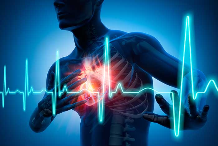 Beim Herzinfarkt zählt jede Minute. Bricht Ihre IT zusammen, muss ebenfalls schnell professionelle Hilfe geleistet werden.